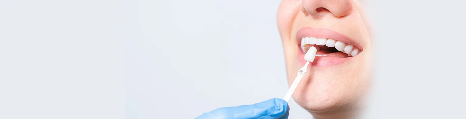 Porcelain Veneers London Banner Image - Pure Harmony Dental Clinic